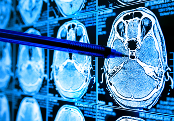 Optimalisatie medische beeldvorming met AI