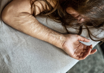 Zelfverwondend gedrag