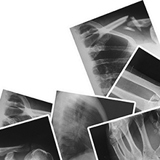 Blauwe ton analyse van digitale radiologie